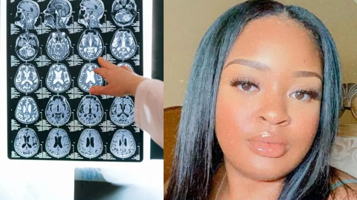 Adriana Smith fue mantenida con soporte vital para que su bebé naciera; el caso pone en foco la ley antiaborto de Georgia. Crédito: Ilustración AMTV